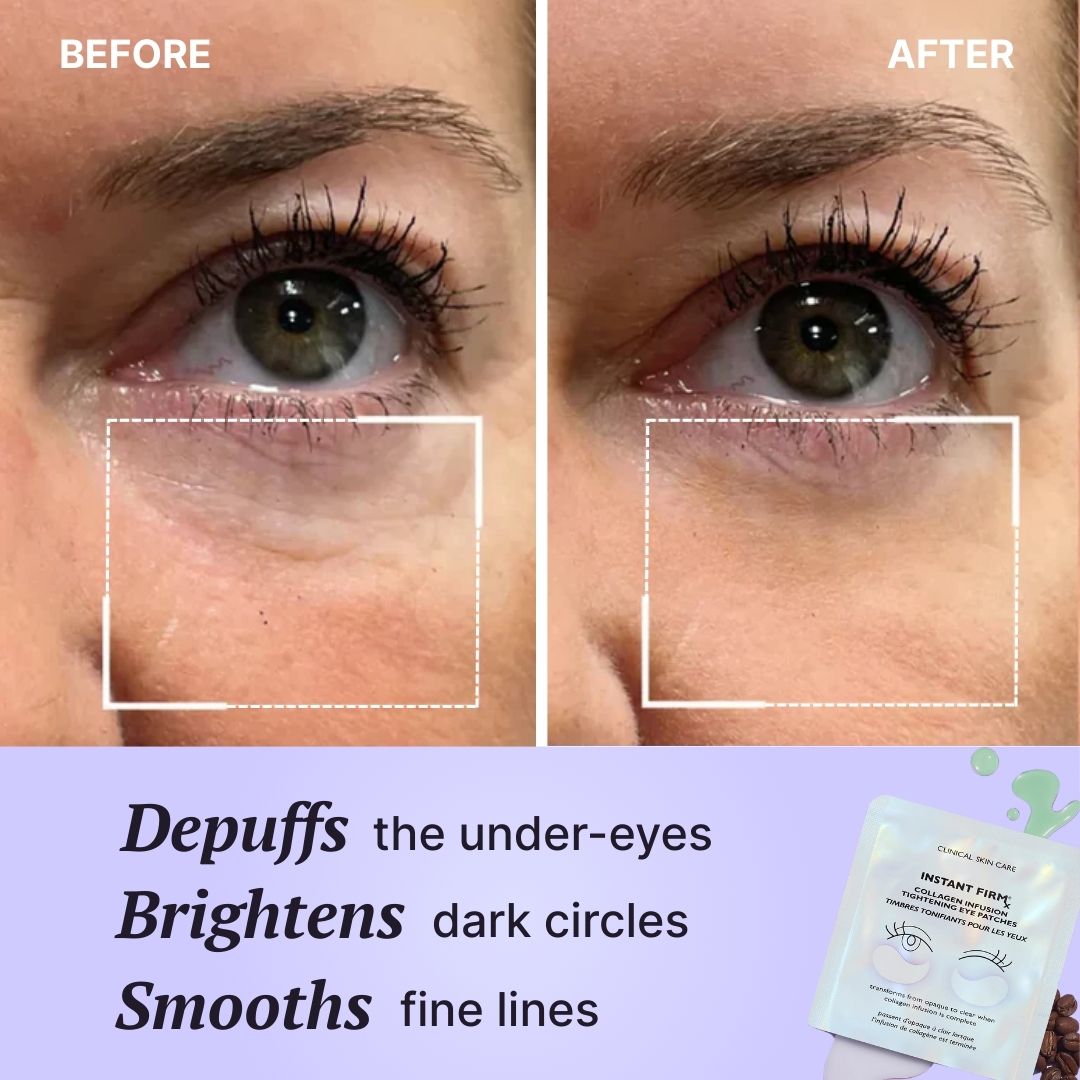 Aurora Pads + Gel de Colágeno GRATIS · Serua™