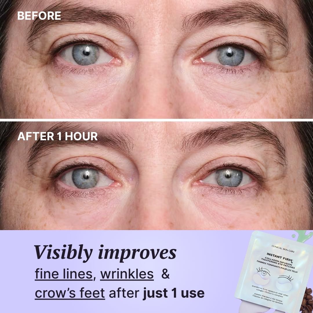 Aurora Pads + Gel de Colágeno GRATIS · Serua™