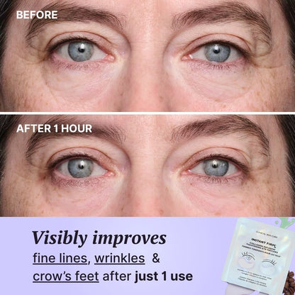 Aurora Pads + Gel de Colágeno GRATIS · Serua™