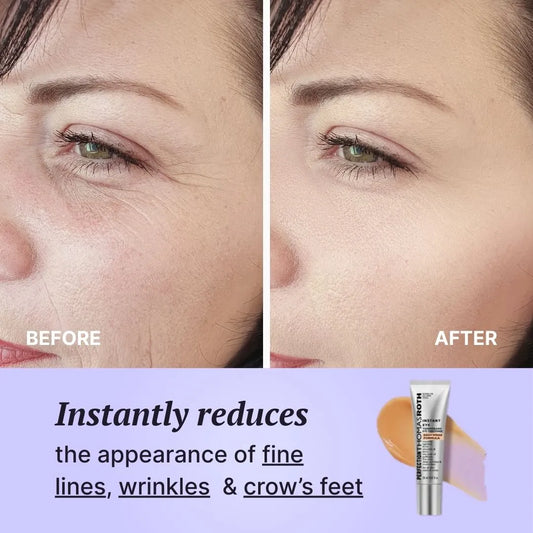 Aurora Eyes · Contorno Revitalizante - Serua™