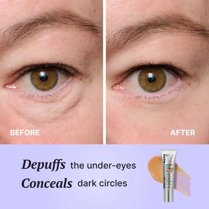 Aurora Eyes · Contorno Revitalizante - Serua™